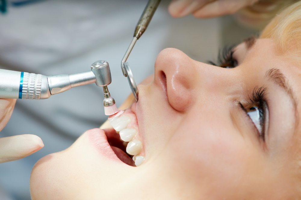 dental cleaning