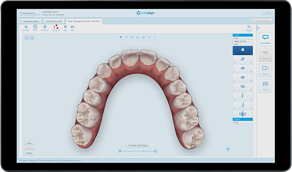 clincheck-c63bdedd3883b5ccb2a8ac79b990b2d42cdcbf0c280bec0ce3c1ed8766d36dc9