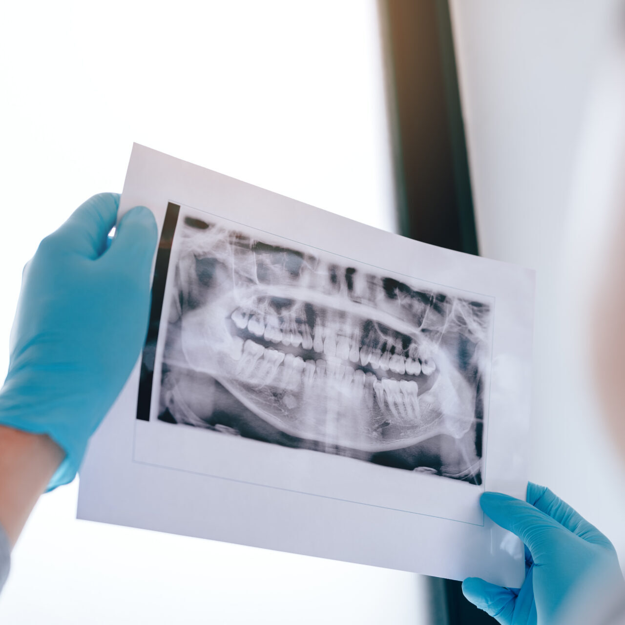 wisdom teeth removal in pakenham at cardinia dental